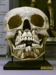 childs-skull-with-adult-teeth-preparing-to-change-the-baby-teeth
